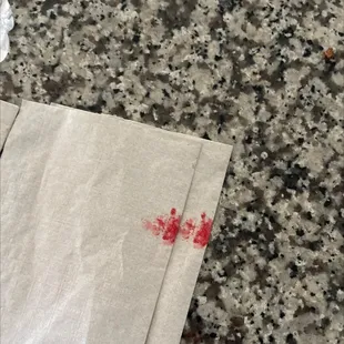 Is this blood on my napkins ???? And can yall pick up the phone ???