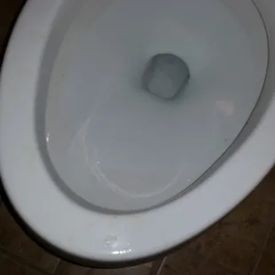 dried urine and pubic hair