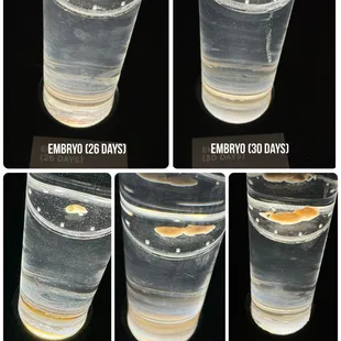 04.05.24 development of an embryo