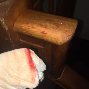 Very obvious blood on the handrail. Red Key "has no idea where it came from" but doesn't find that concerning.