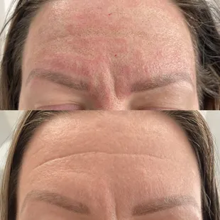 Real client results frown lines