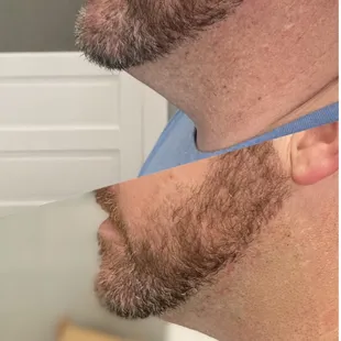 Real client results of neck