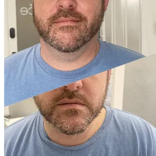 Real client results neck