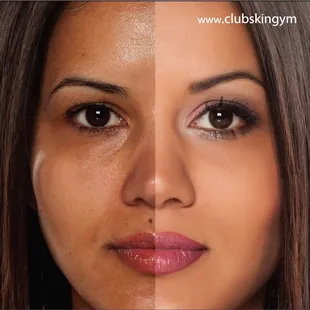 Erase years of damage in minutes!