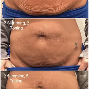 Award winning Cryo T-Shock! Offers a body slimming, cellulite busting, face lifting experience.