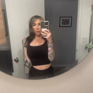 So happy with filler and botox!