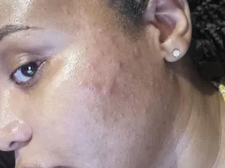 Cosmetic Laser and Beauty Spa