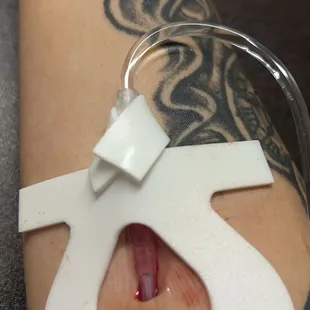 Nobody checked on me for a good 20 to 30 minutes. I could clearly see the blood going back into the IV.