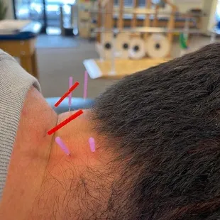 Rio Rancho Physical Therapy
4516 Arrowhead Ridge Dr SE
Rio Rancho, NM 87124