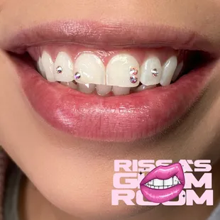 Tooth gems are the new accessory!