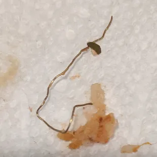 metal that was inside pizza