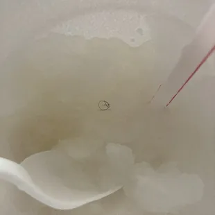 This is hair in my snow ball