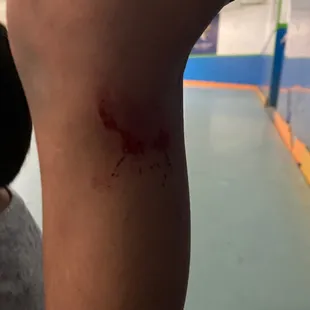 There are nails in the wall that cut you when you hang on the wall,the bathrooms also have not bent cleaned In like 50 years