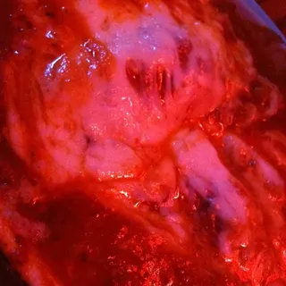 Lasagna