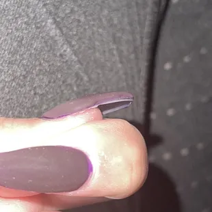 The acrylic isn't even matching up to the nail on my thumb