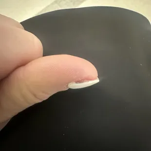 Blood and bruising under nail