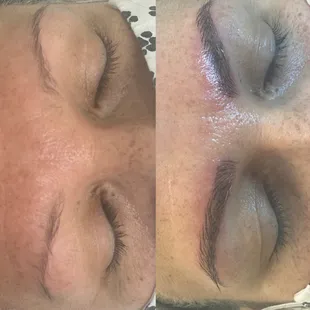 Microblading
