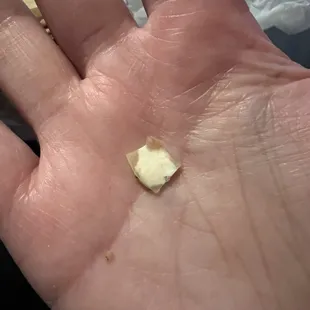 A shards of hard plastic that I found in my burrito