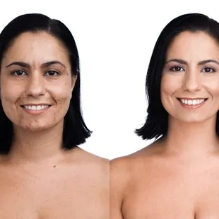 Jane Irdale The Skin Care Makeup covers Hyperpigmentation. Products used Pussd foundation, Enlten Concealer and Pommist hydar...