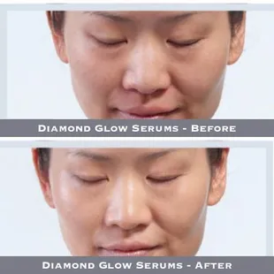 Diamond Glow Serums - Before-After