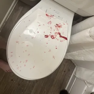 The bloody toilet from him trying to greet me