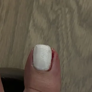 Big toe with over trimmed cuticles! It's swollen and bloody :( And regular polish smh but that's my fault for not doing gel.