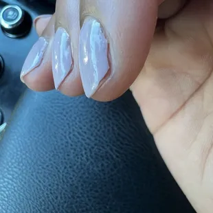 Chipped nails