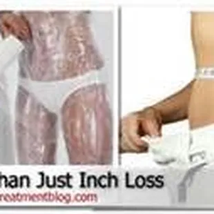 Permanent inch loss, skin tightening and cellulite reduction.