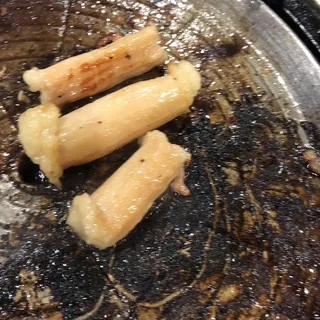 Large Intestine