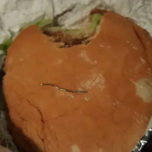 Sharp object in my hburger...