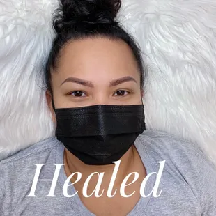 Healed brows