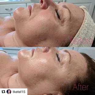 Moisture Lock Treatment &amp; The Pigment Corrector Treatment combined with an added Pearl and Silk Seaweed Mask Very happy with the results.