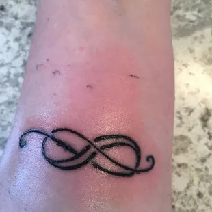 My granddaughter&apos;s tattoo. BOTH PHOTOS TAKEN TODAY. 5 DAYS AFTER.