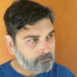 Candace of Skin Deep Esthetics by Candace: Amazing!