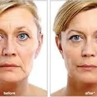SkinRN Aesthetics