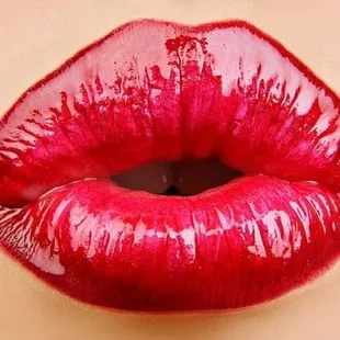 Specializing in natural looking lip augmentation