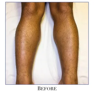 Before a waxing service