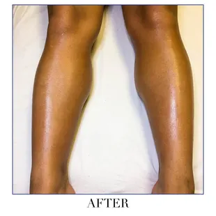 Silky smooth skin after a leg wax