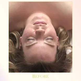 Facial Before Shot - Scottsdale Arizona 2019