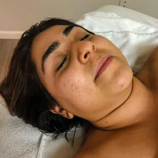 Facial Client Before Shots - Scottsdale Arizona 2019