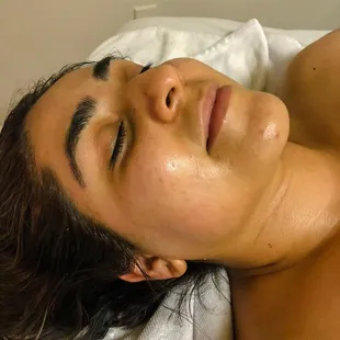 Facial Client After Shots - Scottsdale Arizona 2019