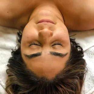 Facial Client Before Shots - Scottsdale Arizona 2019