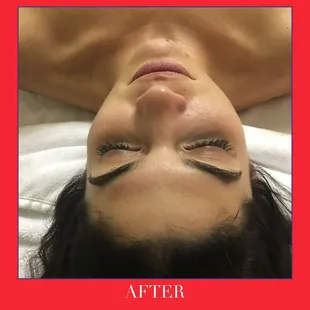 After a Brightening Facial