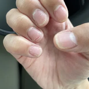 These are my ripped nails after she had taken off my powdered full set.