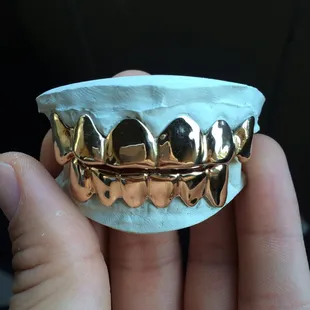 They even do gold grills wow