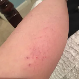 Damages and injuries from 4/24/19 incident sent to management.