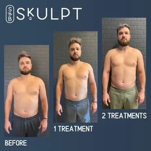 Body contouring by Soul &amp; Beauty