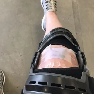 My injury. I got bucked off an electric scooter on Ocean Drive.