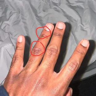 My son's hands, so glad he felt the stinging!