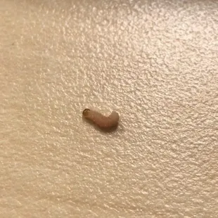 Worm found in my pistachios
